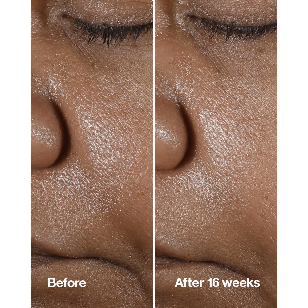 Clinique Smart Clinical Repair Wrinkle Correcting Serum