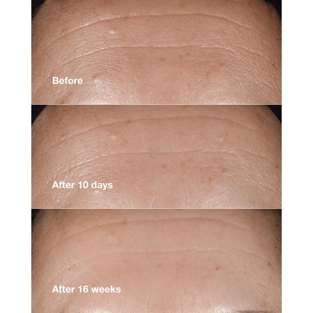Clinique Smart Clinical Repair Wrinkle Correcting Serum