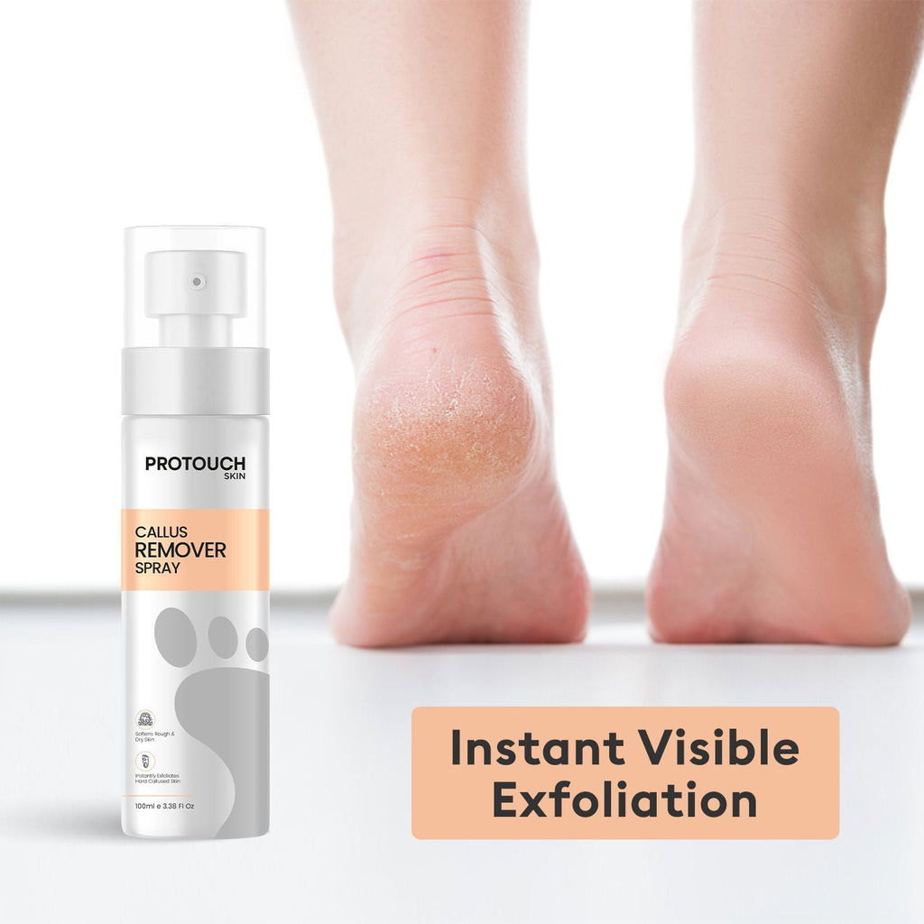Protouch Callus Remover Spray