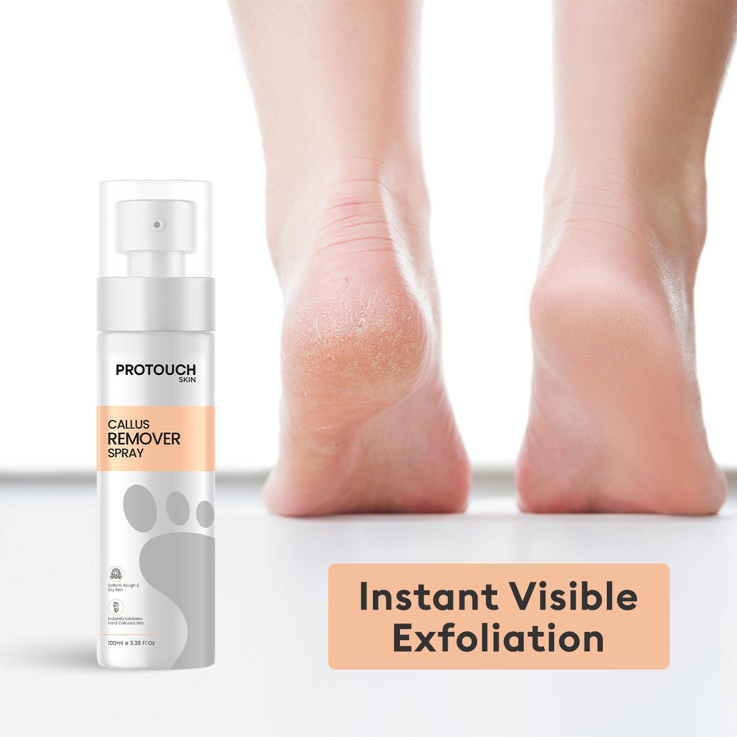 Protouch Callus Remover Spray