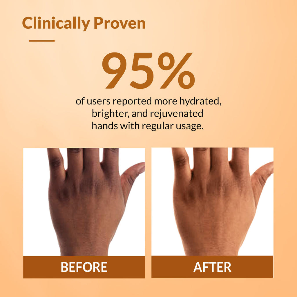 Fixderma Hand Cream for Women & Men | Hand Moisturizer | Hand Cream for Dry & Rough Hands