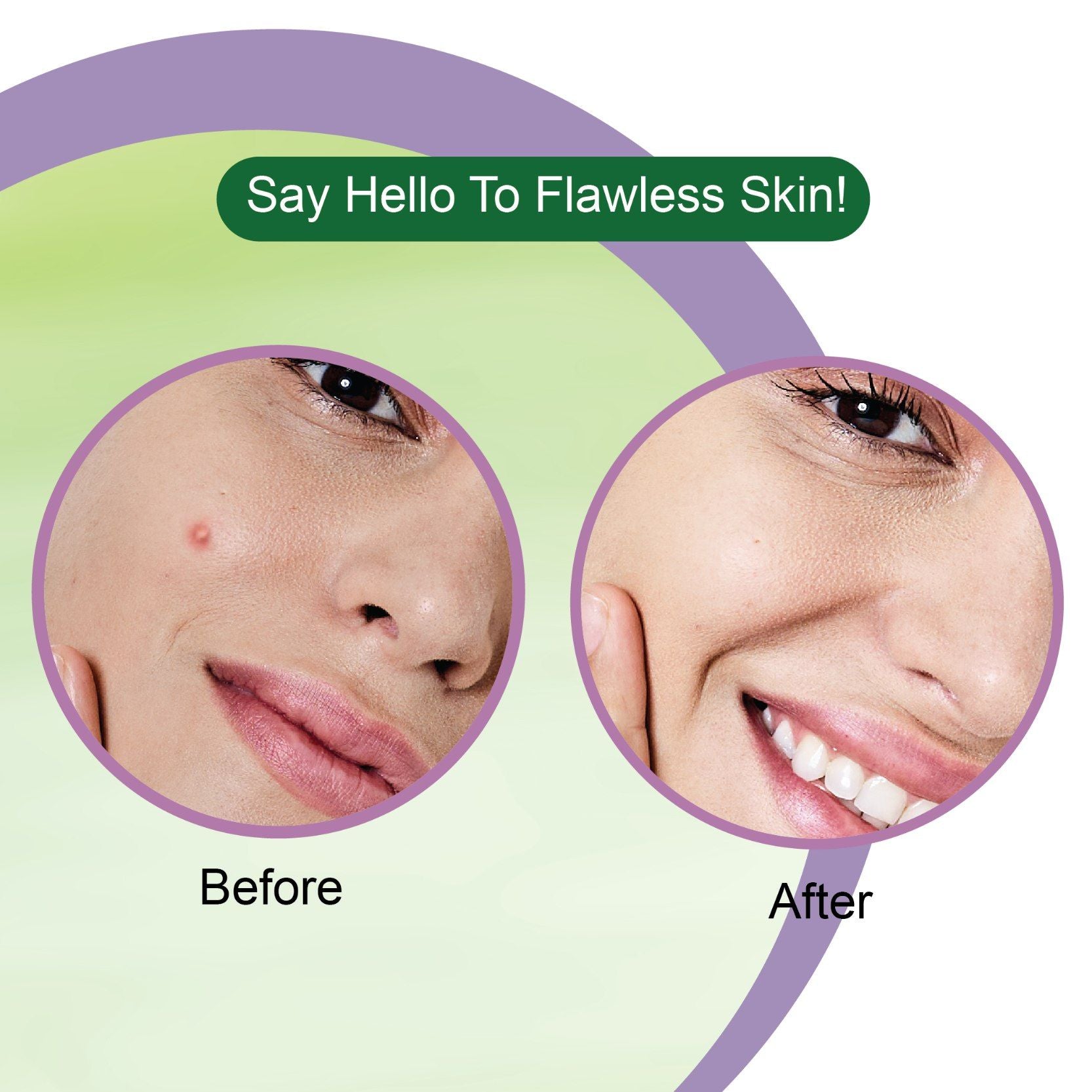 DR. RASHEL Neem Acne Pimple Patch