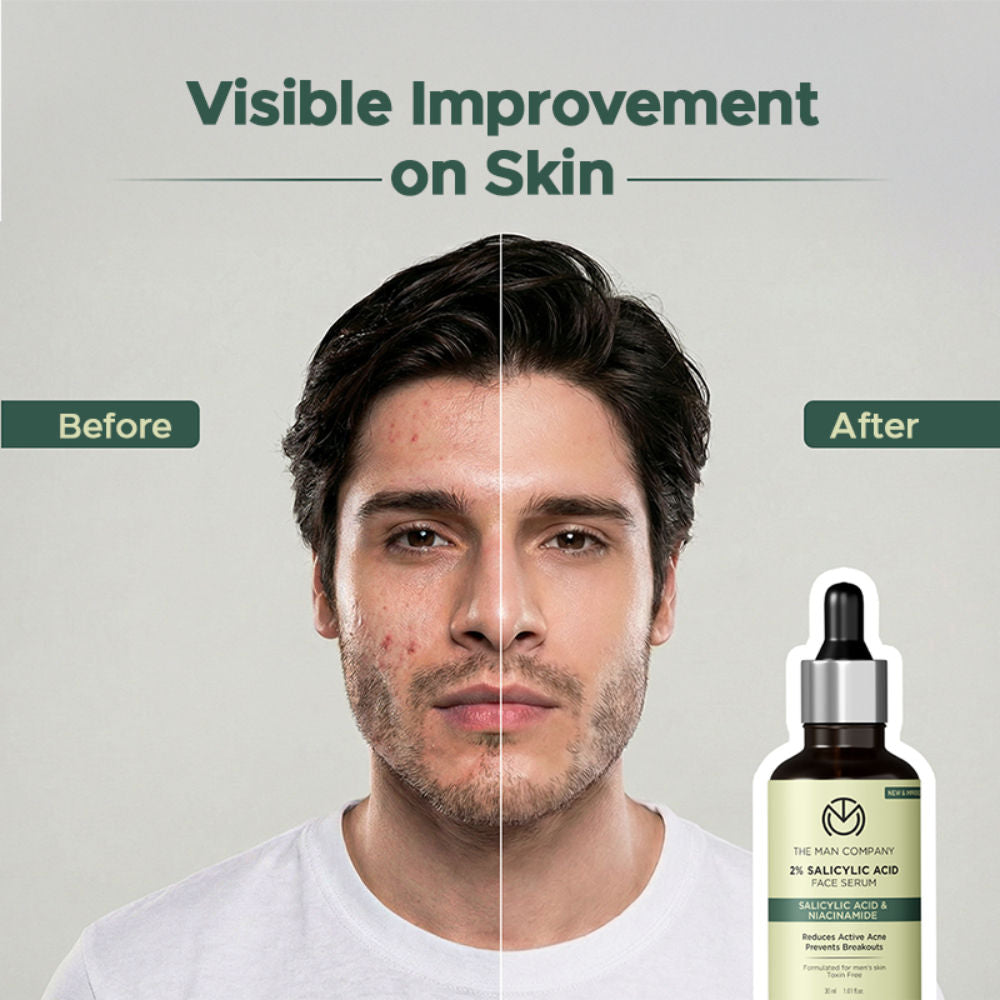 The Man Company 2% Salicylic Acid Face Serum