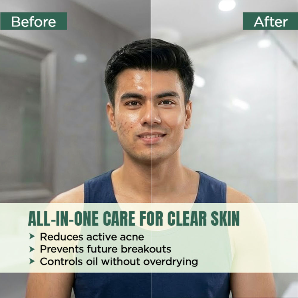 The Man Company Anti Acne Face Wash