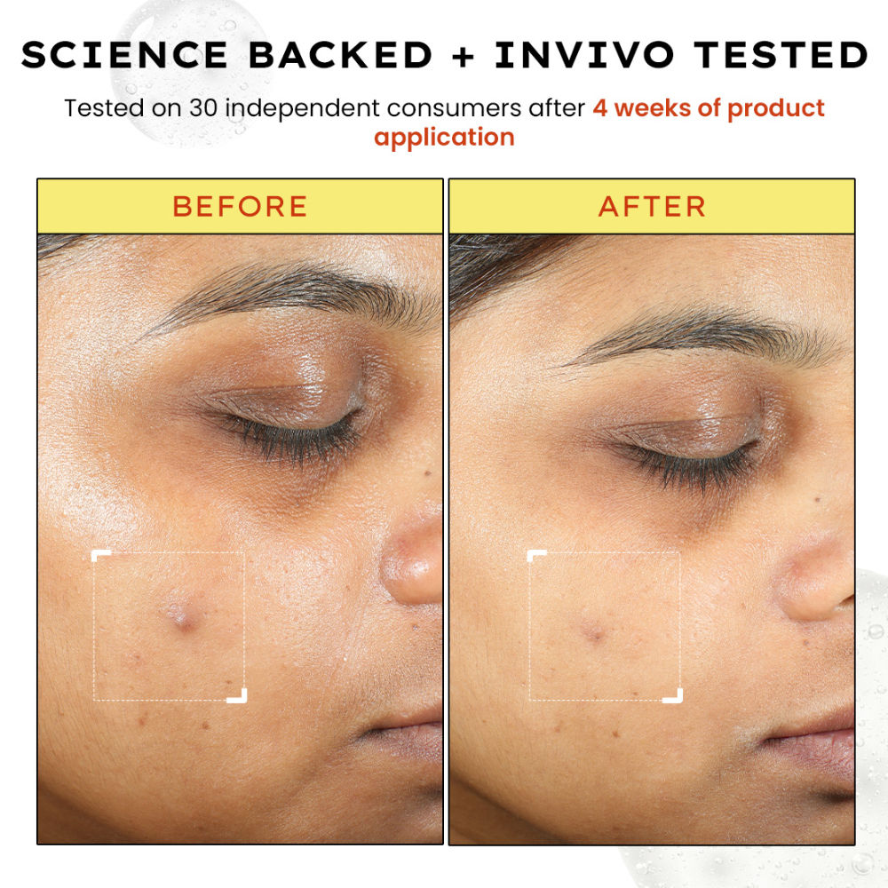 Hyphen 10% Vitamin C Serum with 1% Vitamin E & Ferulic Acid, Brightens & Fade Dark Spots