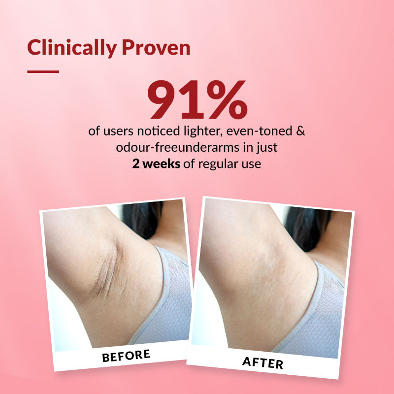 Fixderma Nigrifix 6% AHA Underarm Lightening Roll On Velvet Musk