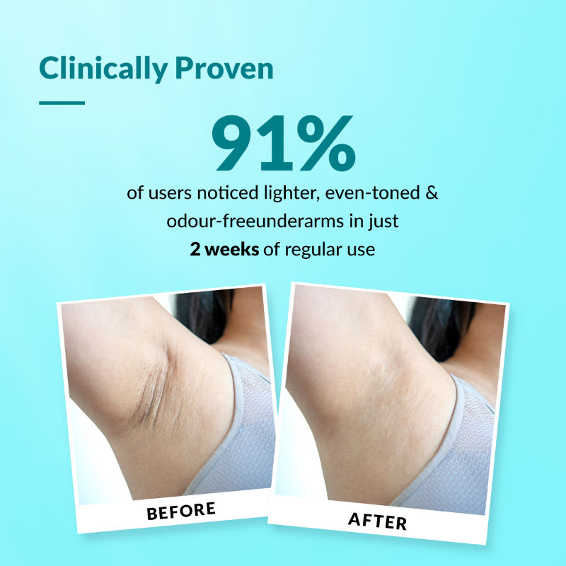 Fixderma Nigrifix 6% AHA Underarm Lightening Roll On Ocean Fragrance