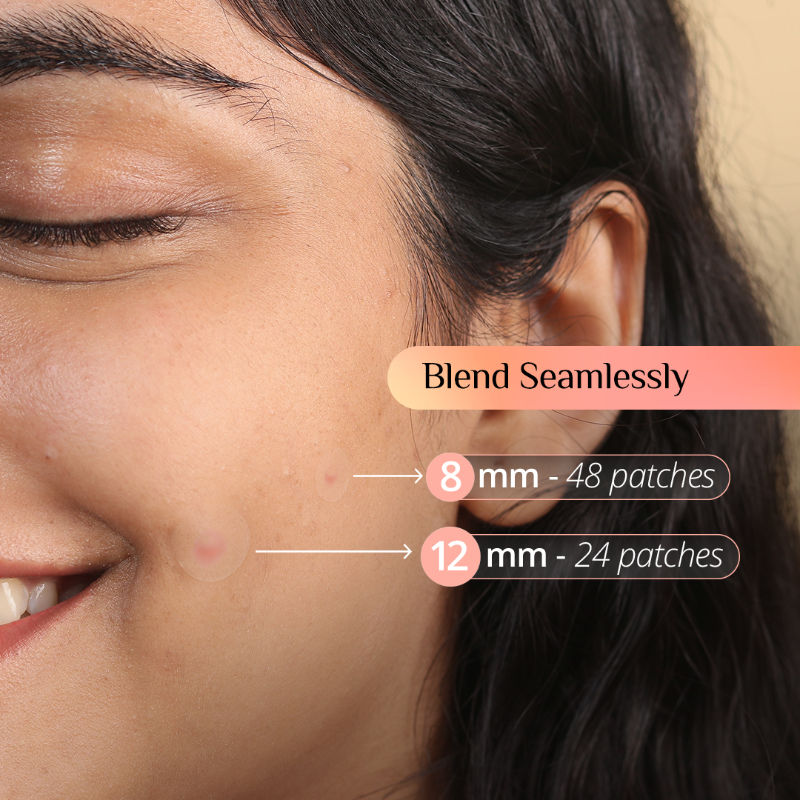 Carmesi Pimple Patch for Acne, 72 Hydrocolloid and Salicylic Acid Patches, For All Skin Types