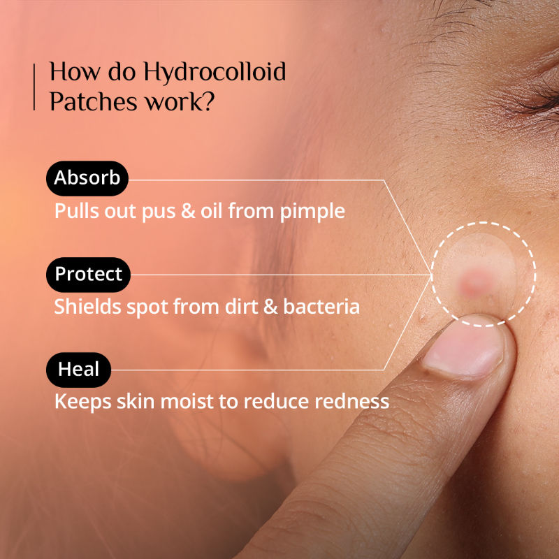 Carmesi Pimple Patch for Acne, 72 Hydrocolloid and Salicylic Acid Patches, For All Skin Types