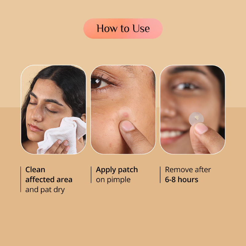 Carmesi Pimple Patch for Acne, 72 Hydrocolloid and Salicylic Acid Patches, For All Skin Types