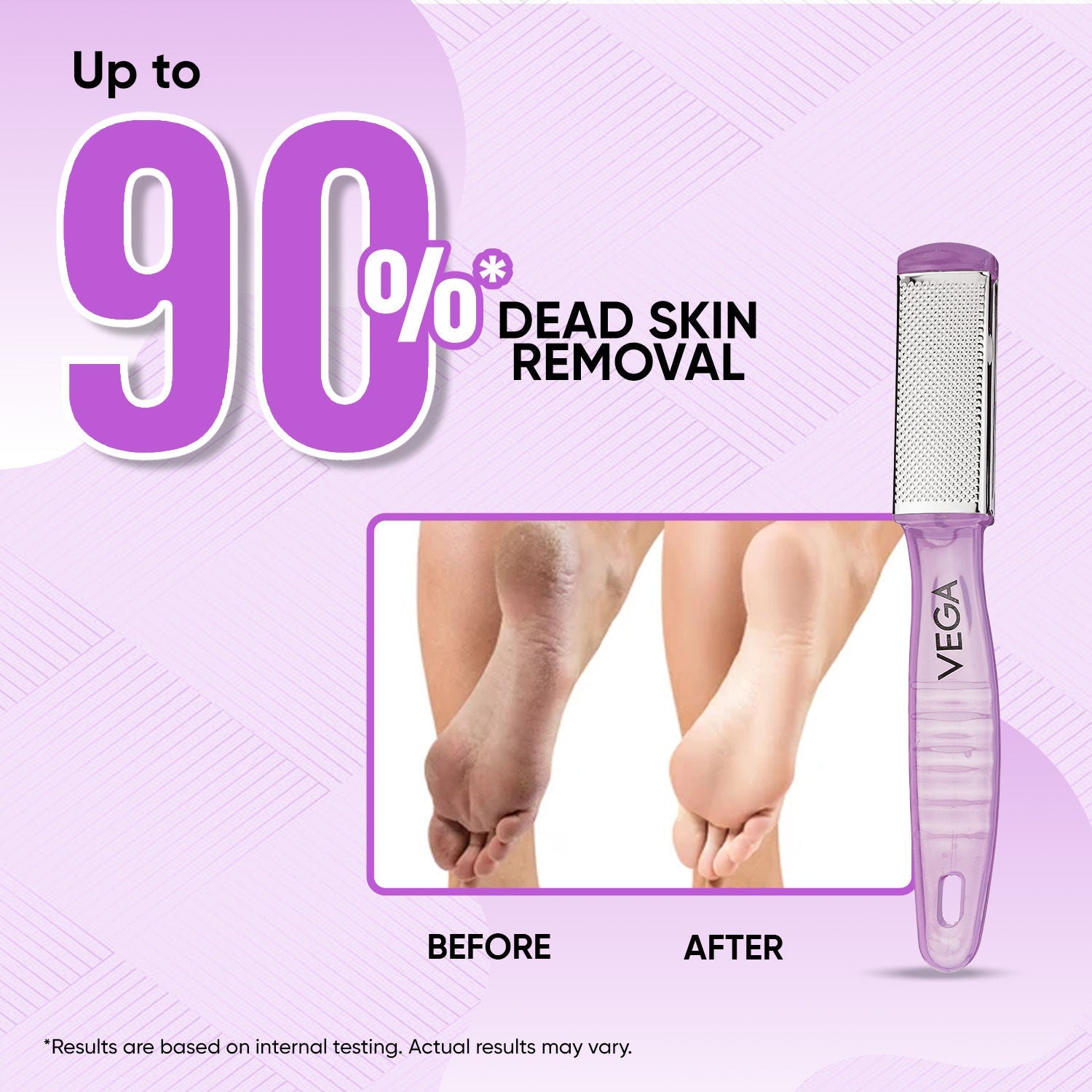 VEGA Pedicure Foot File–Dual-Sided Foot Scrubber for Remove Dead Skin, Callus (PD-03)