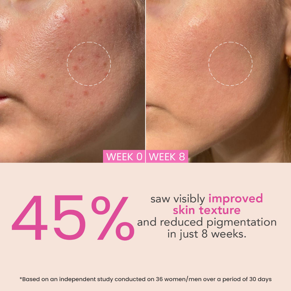 O3+ Night Repair Cream - Moisturiser For Brightening & Glow Boosting | Fades Finelines & Wrinkles