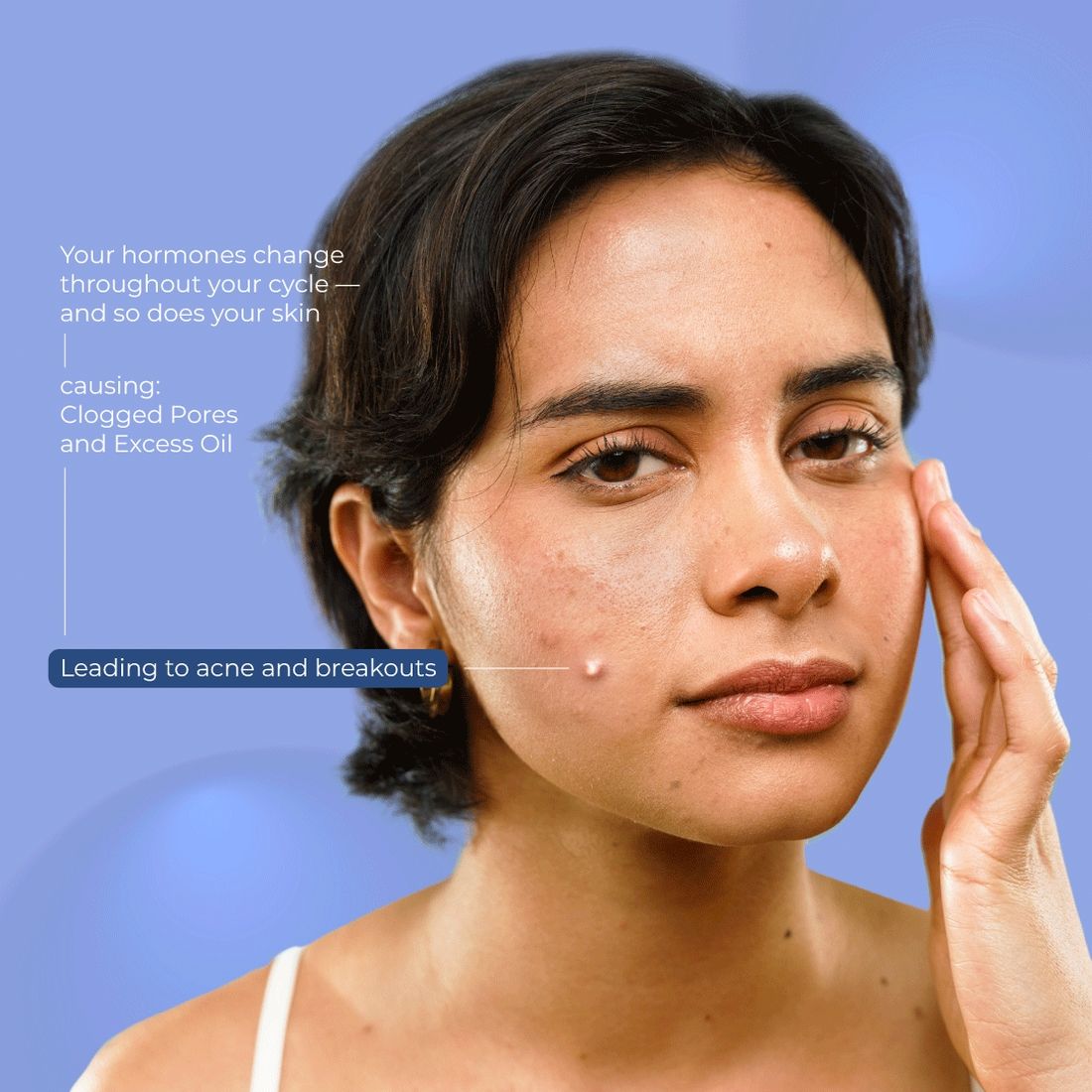 Nua Pimple Patch for Acne - 36 Hydrocolloid and Salicylic Acid Patches - For All Skin Types