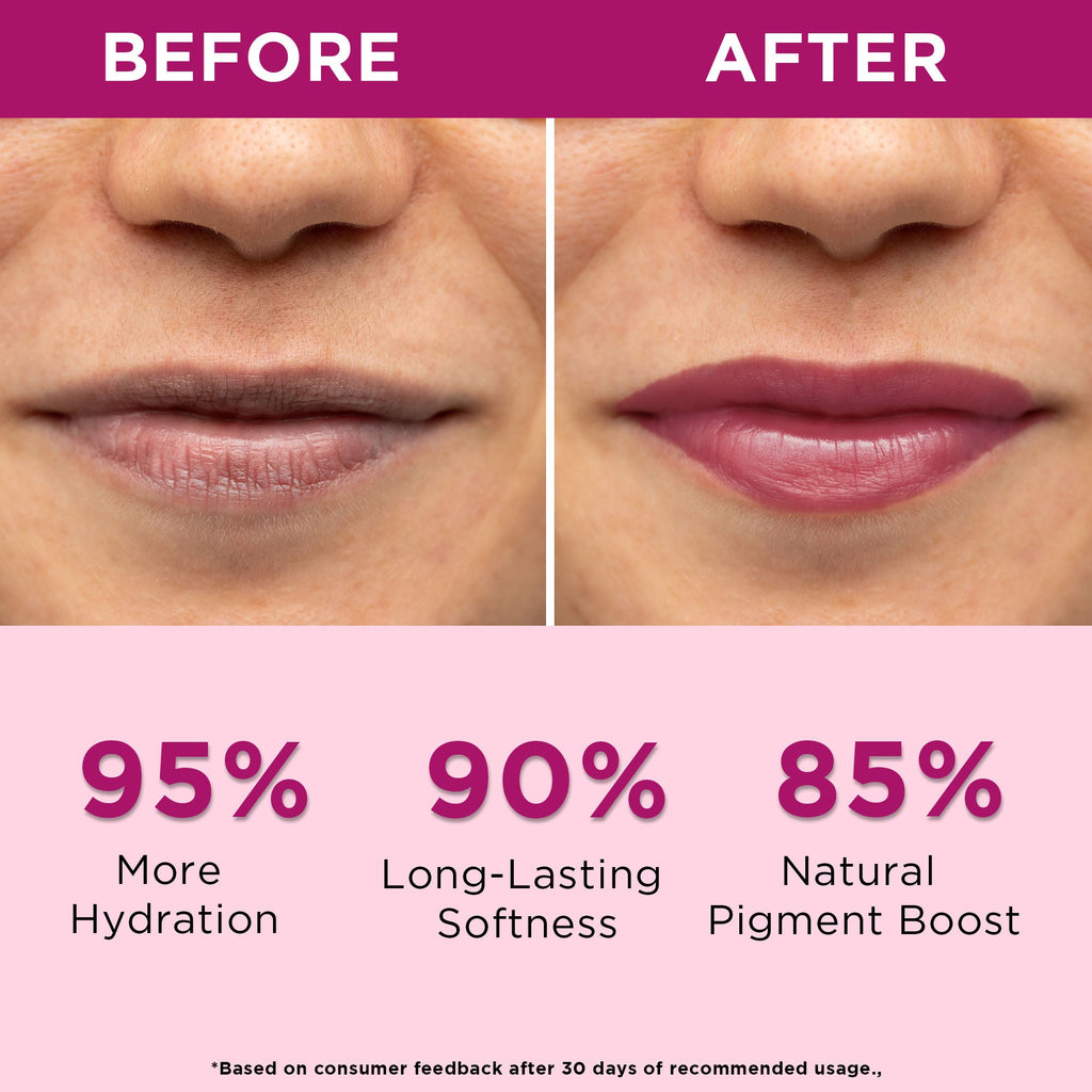 Orgatre Beetroot Tinted Lip Balm SPF 30 PA++ with Ceramide & Kojic Acid for Brighten Dark Lips
