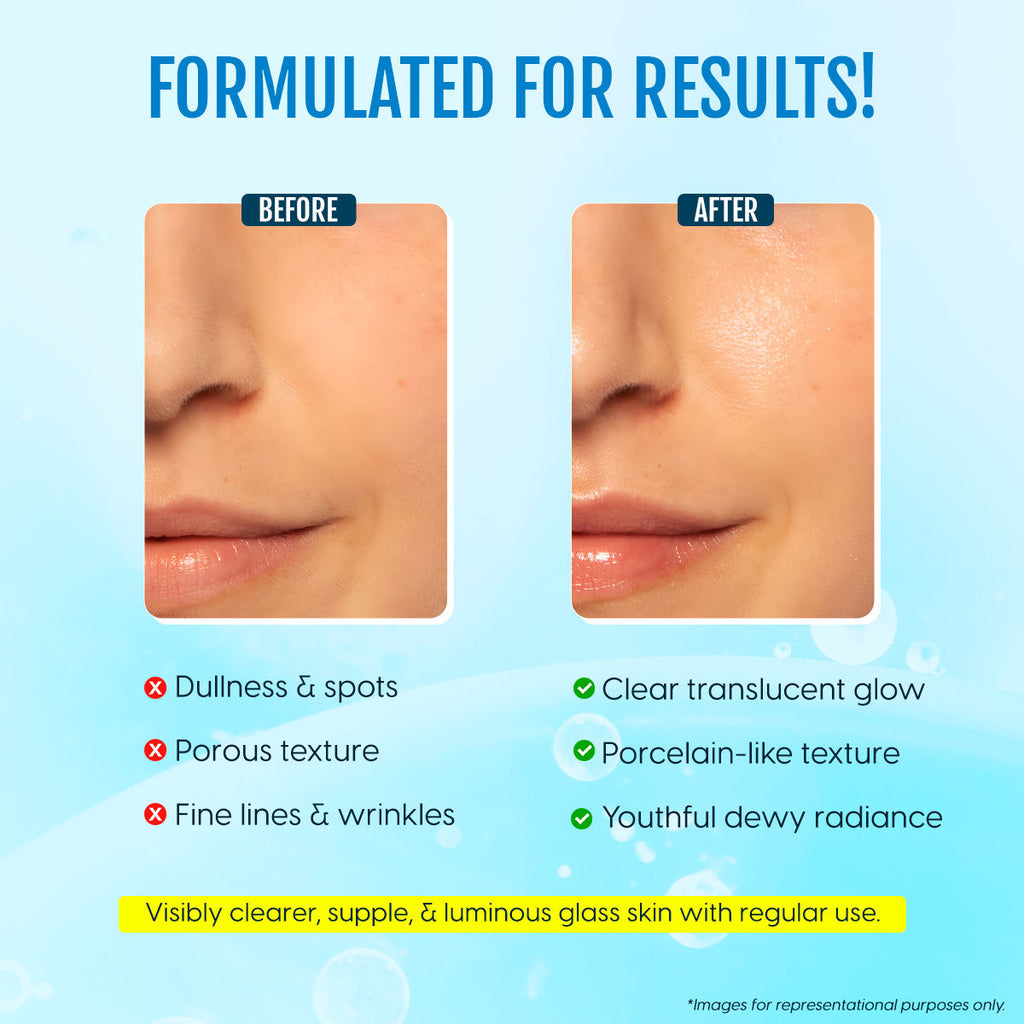 Matra Korean Glass Skin Serum With Salicylic Acid & Lactic Acid For Spotless Glow & Anti Aging