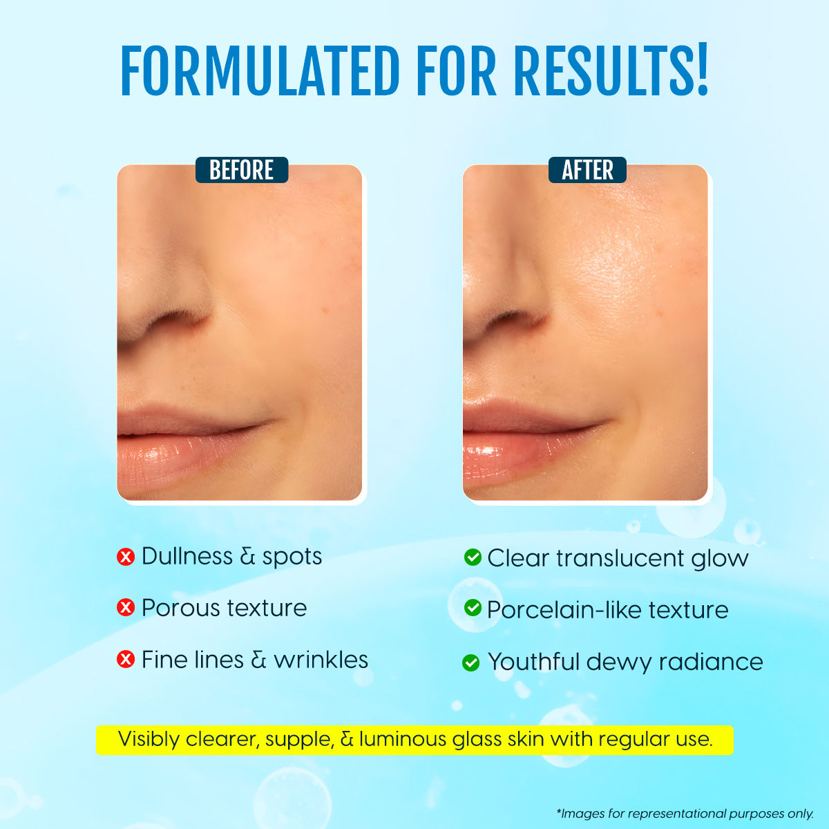 Matra Korean Glass Skin Serum With Salicylic Acid & Lactic Acid For Spotless Glow & Anti Aging