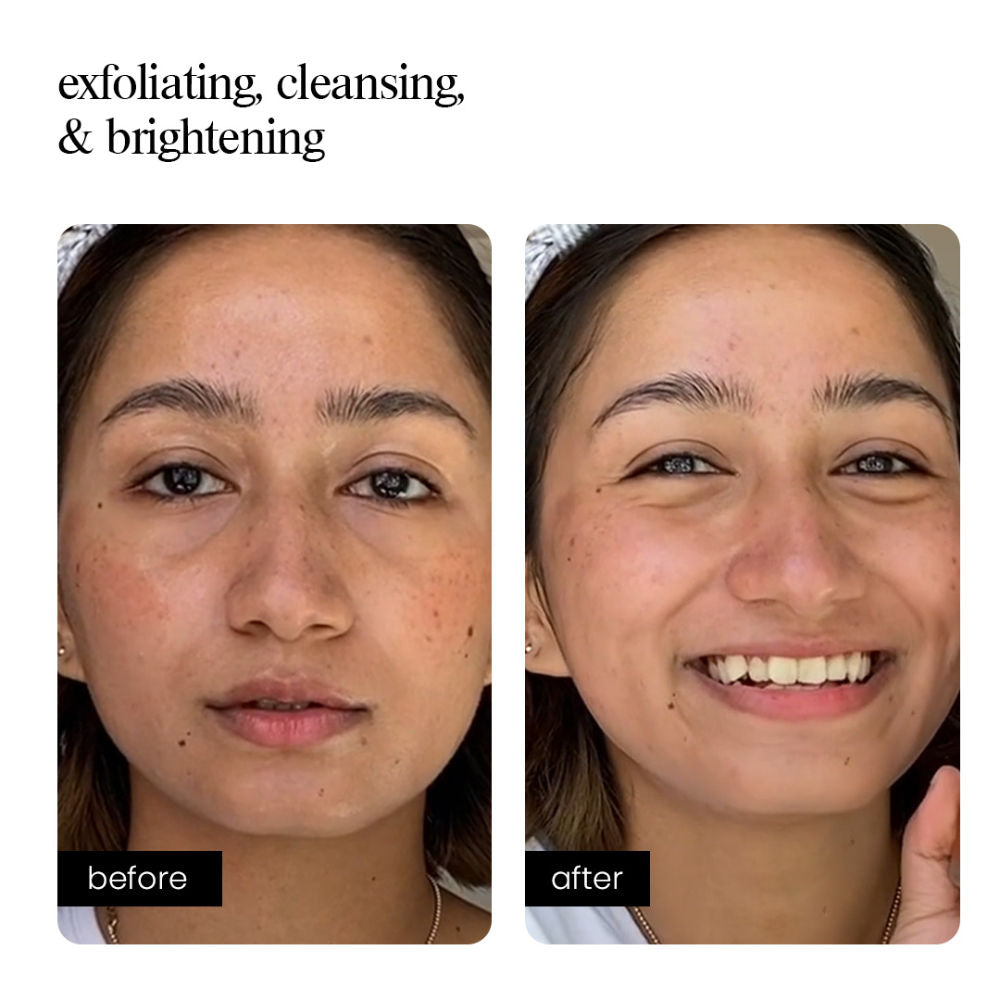 Aminu AHA Face Wash – Exfoliating & Brightening Cleanser for Dull Skin, Acne Marks & Dark Spots