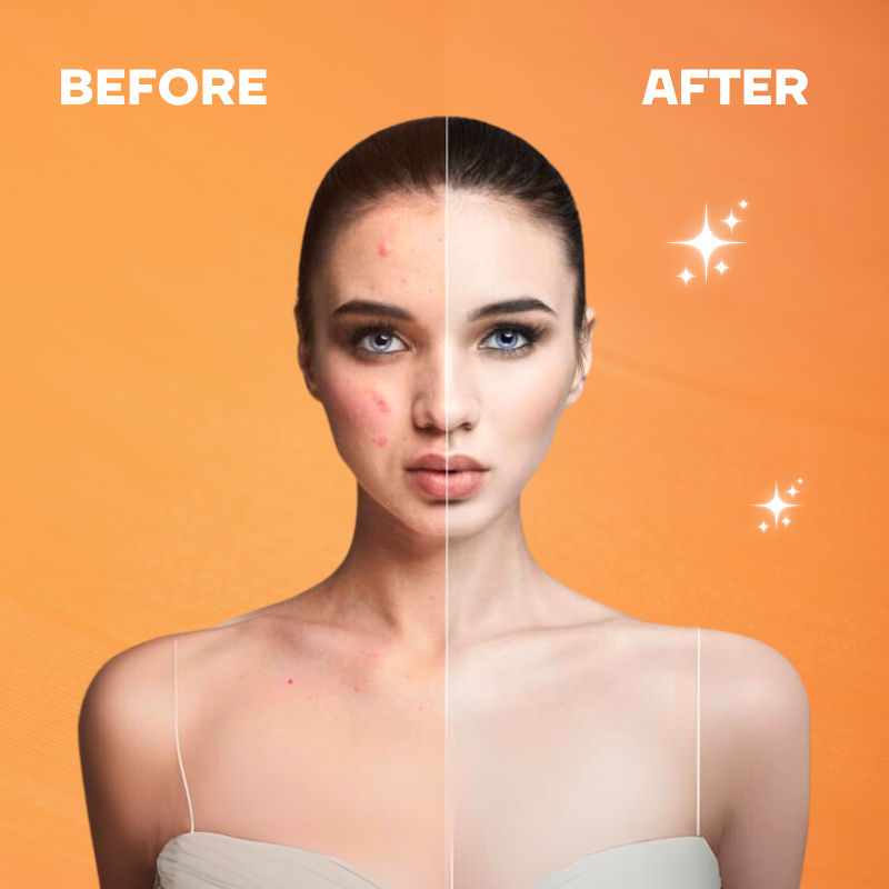Mountainor Sunscreen for Oily Skin, Anti Acne UV Face Gel SPF 50 PA++++ Glow, Matte & No White Cast