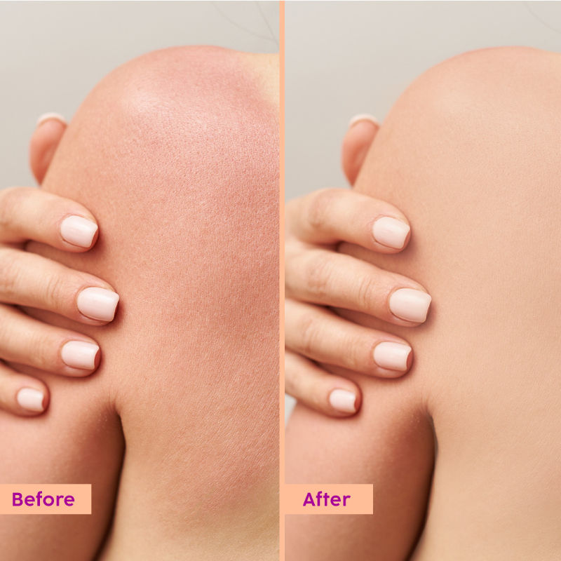 Plix Peaches & Lemon Detan Body Lotion with SPF 30