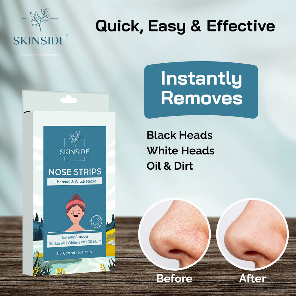 SKINSIDE Nose Strips With Charcoal & Witch Hazel