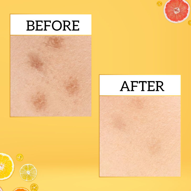 inatur Vitamin-C Serum with Hyaluronic Acid, Amla & Turmeric, Lightweight Formula for Glowing Skin