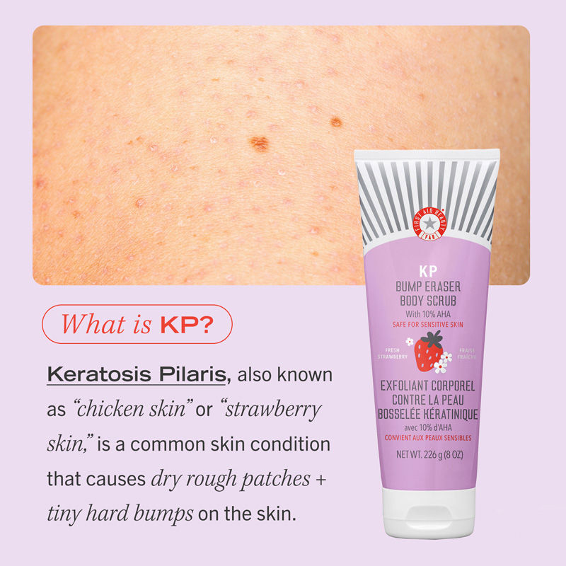 First Aid Beauty Strawberry KP Bump Eraser Body Scrub 10% AHA