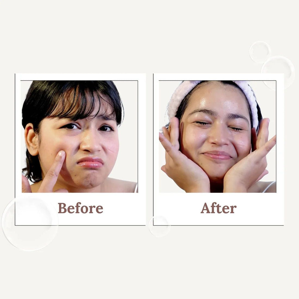 SUROSKIE Glow Grain Rice Enzyme Cleanser For Glowing & Hydrated Skin