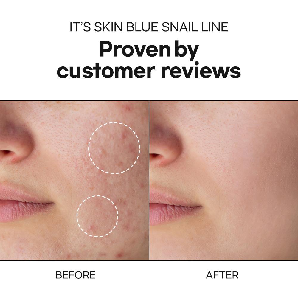 It's Skin Blue Snail Moisturizer
