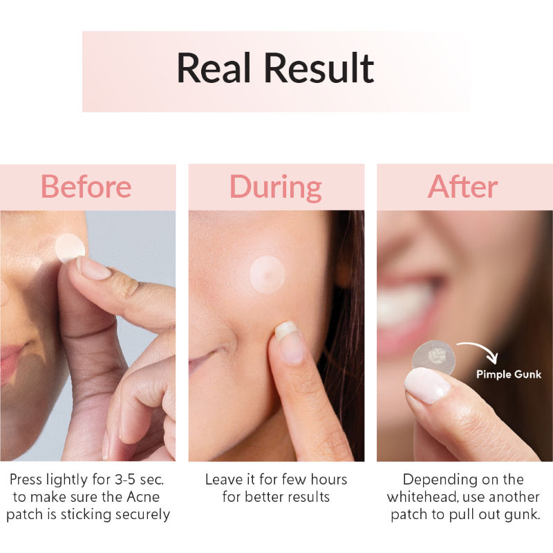 Priveda Spot Clearing Acne Pimple Patch