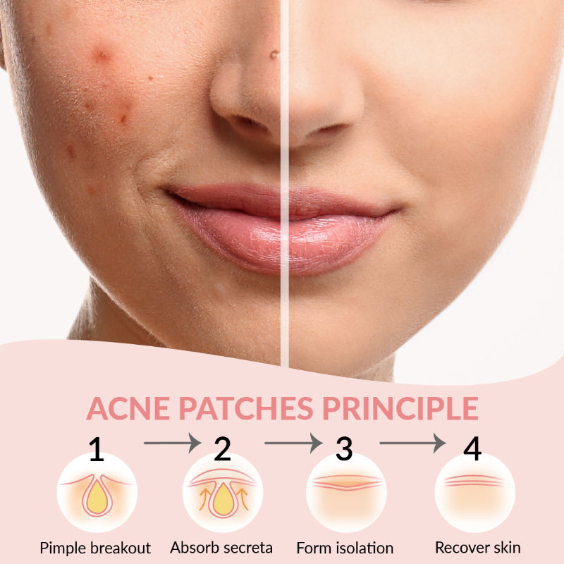 Priveda Spot Clearing Acne Pimple Patch