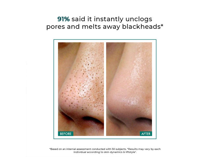 Conscious Chemist Blackhead Melting Water Mini