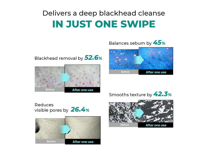Conscious Chemist Blackhead Melting Water Mini