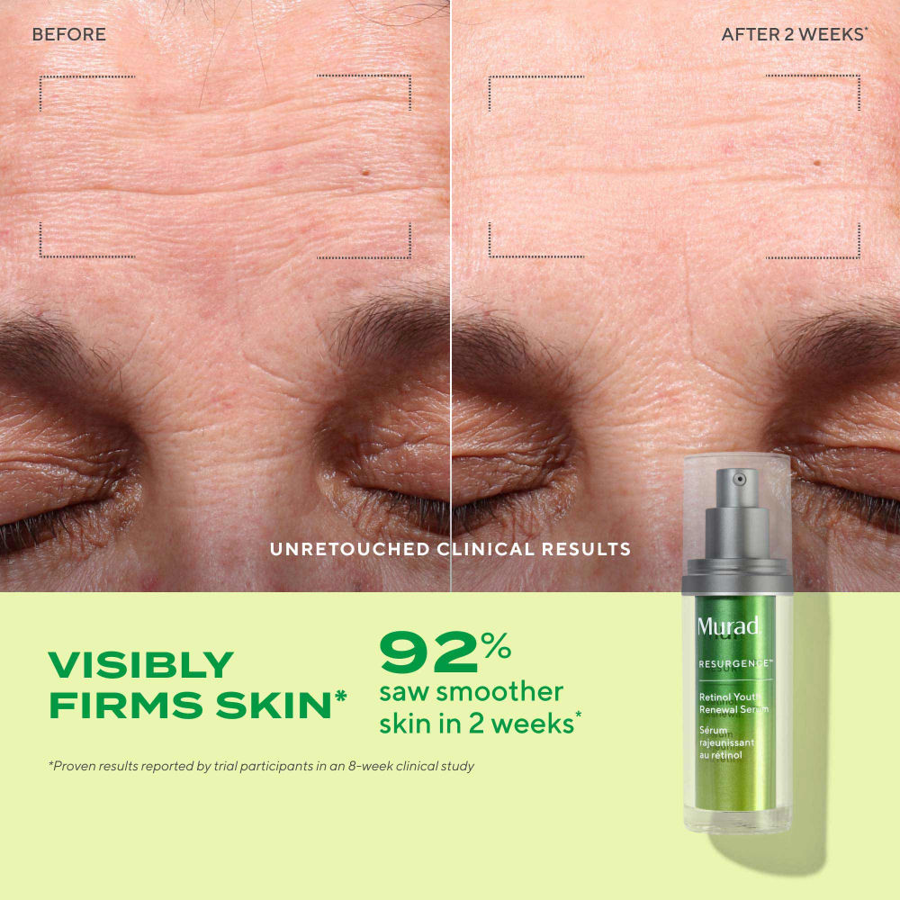 Murad Retinol Youth Renewal Serum